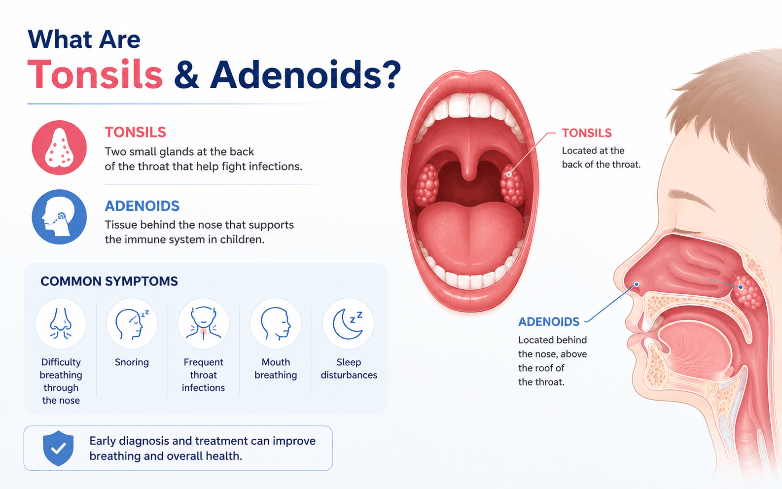 Homeopathic Treatment for Tonsils and Adenoids in Moshi